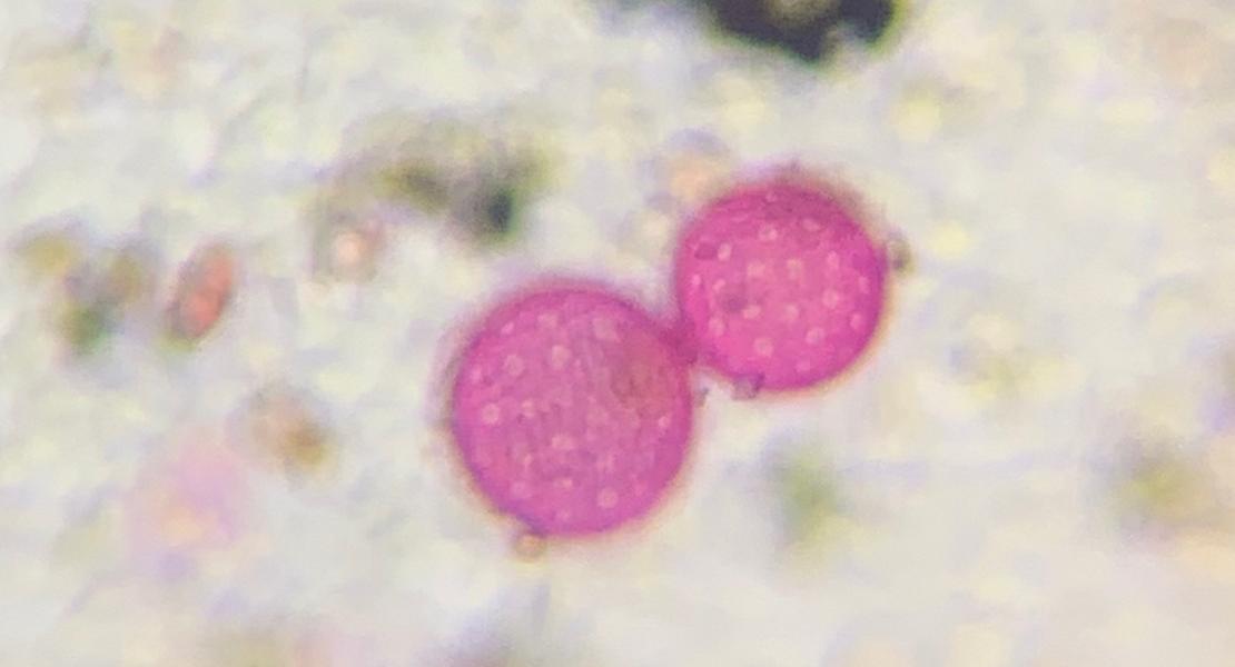 Chenopod weed pollen.